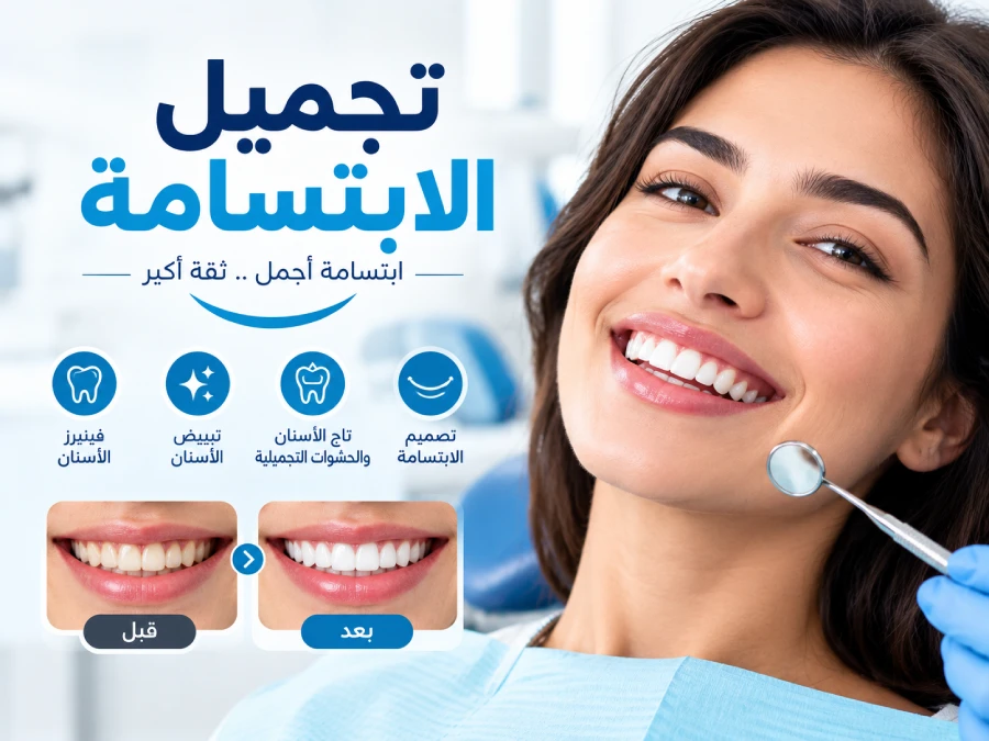 تجميل الابتسامة
