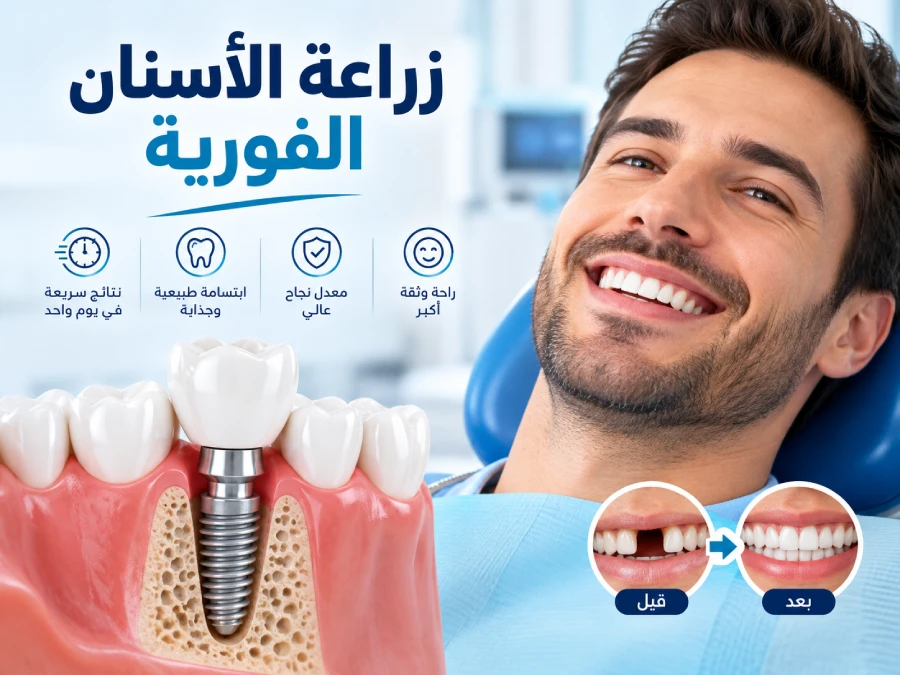 زراعة الأسنان الفورية في الهند